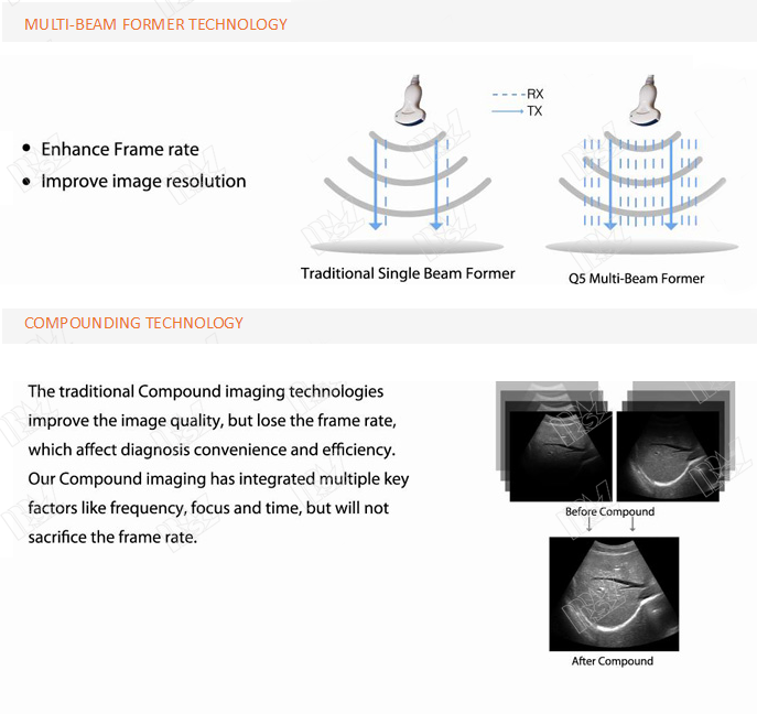 ultrasonido renal chison q5