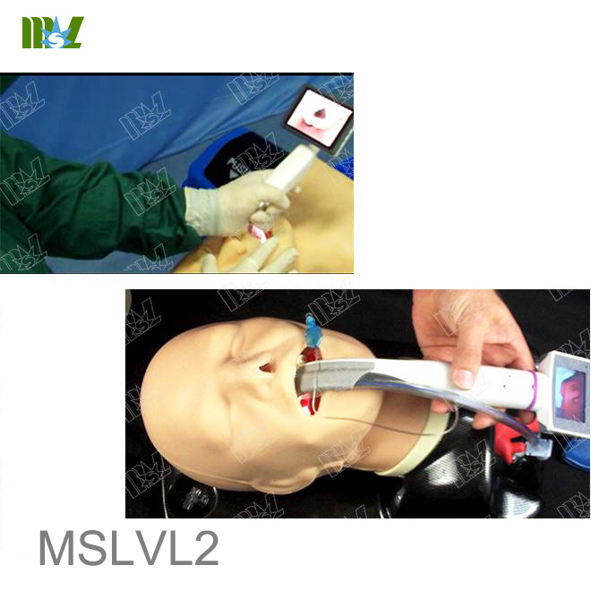 mccoy laryngoscope