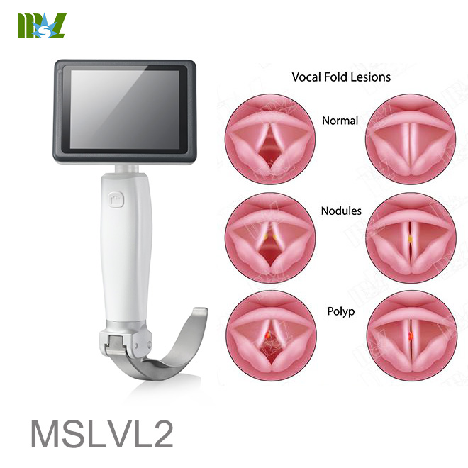 laryngoscopy video