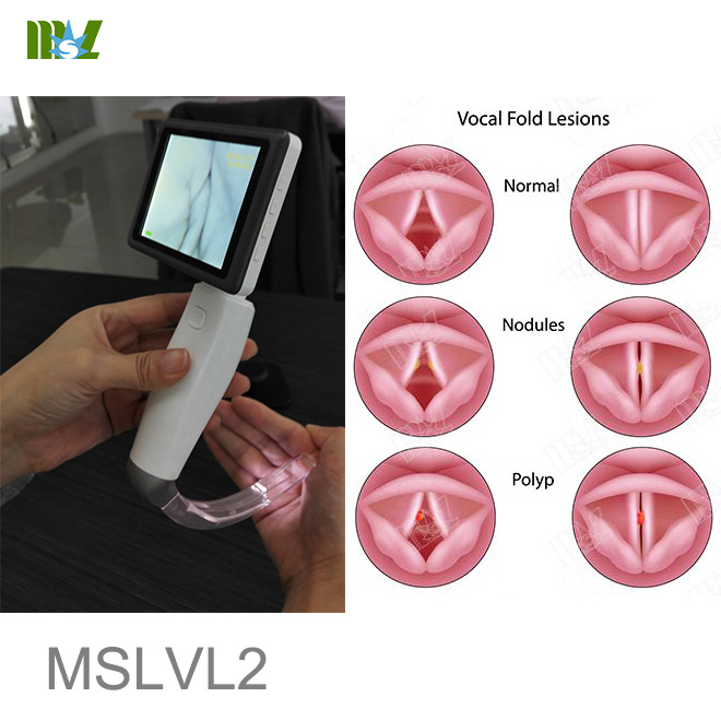 laryngoscopy cost