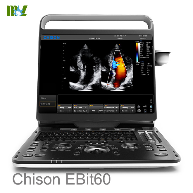 Chison EBit 60