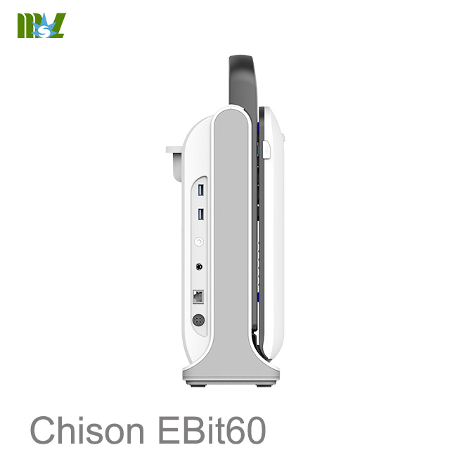 Ecografie parti moi Chison EBit 60