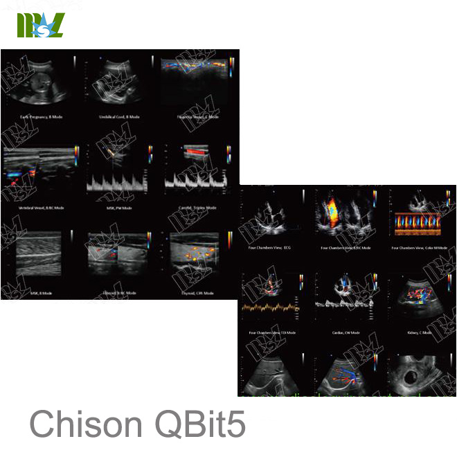 veterinary ultrasound Chison QBit 5