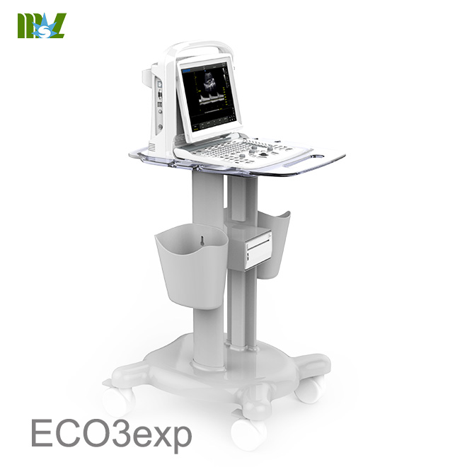 Eco doppler carotidian