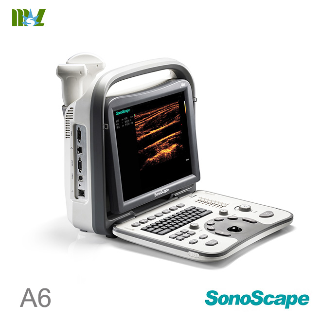 Sonoscape ultrasound sonoscape a6 price: ultrasound machine