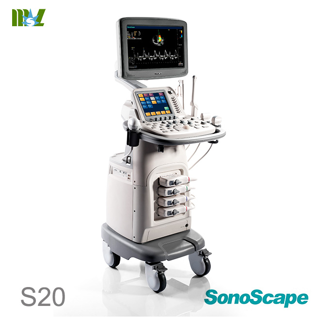 ecografie endovaginala SonoScape S30 price | ecografie doppler