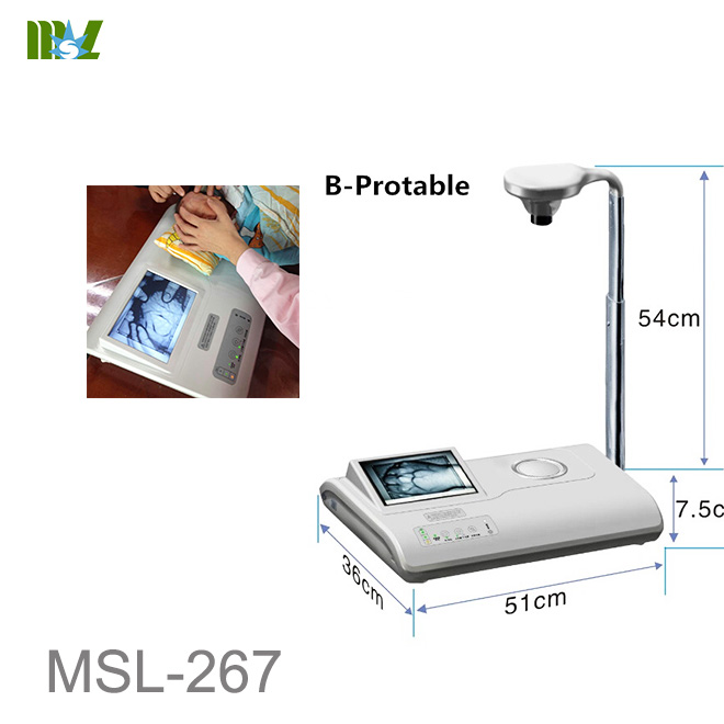 vein finder light MSL-267