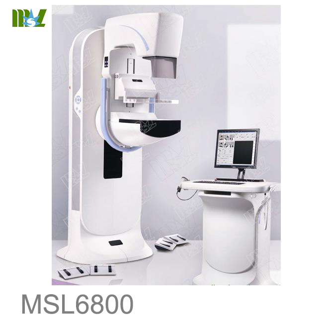 digital mammography