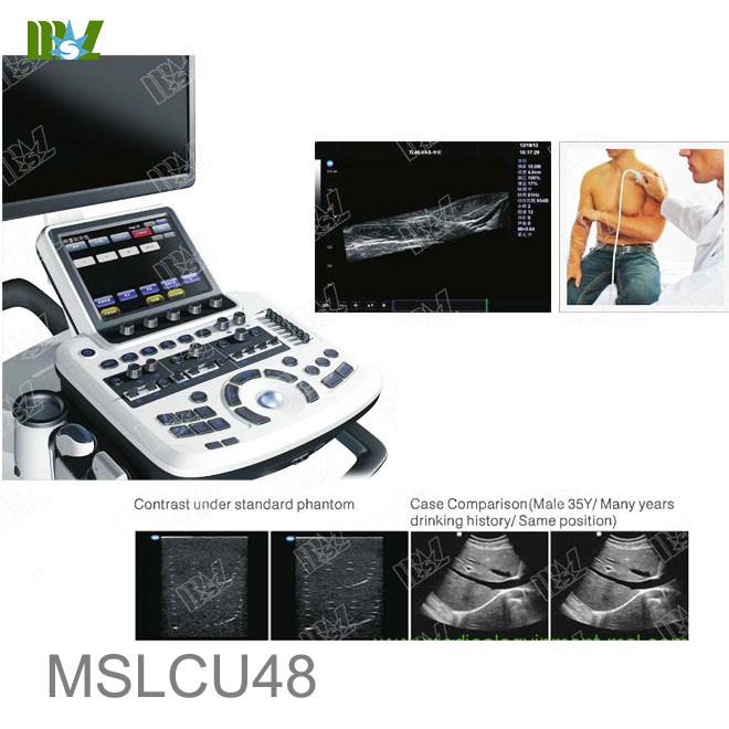 msk ultrasound