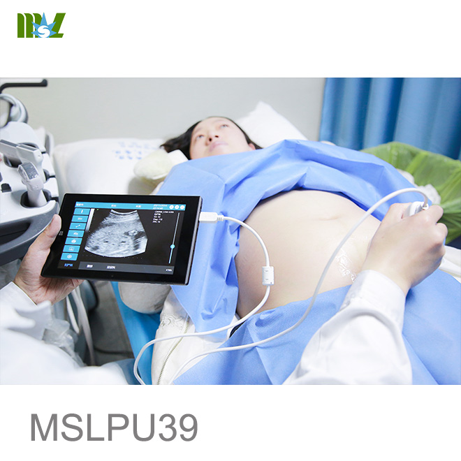 Abdominal USB Ultrasound Probe