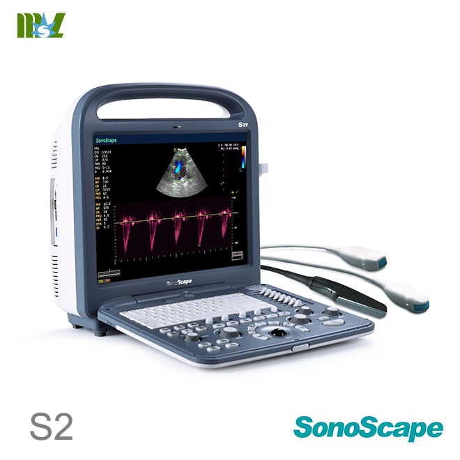 Factory direct sales ecografo sonoscape s2 price list