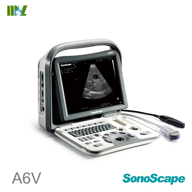 SonoScape A6v veterinary ultrasound : ultrasonido obstetrico