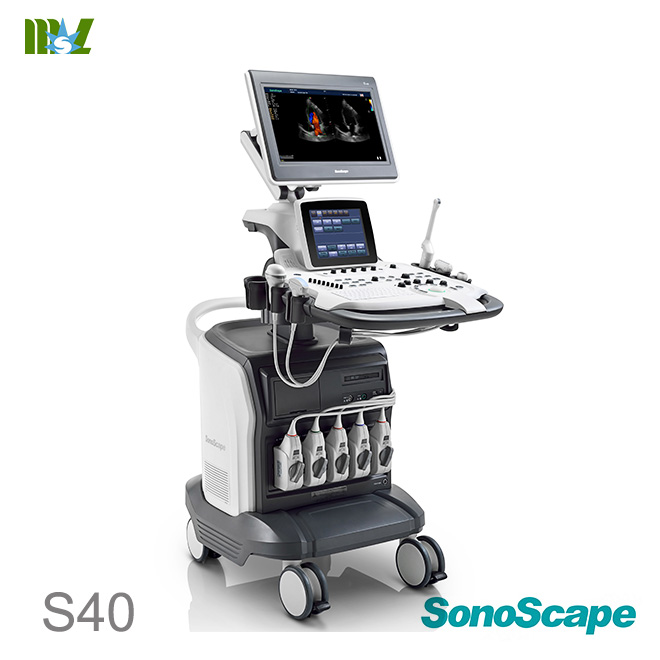 doppler vascular SonoScape S40 price | ecografie doppler