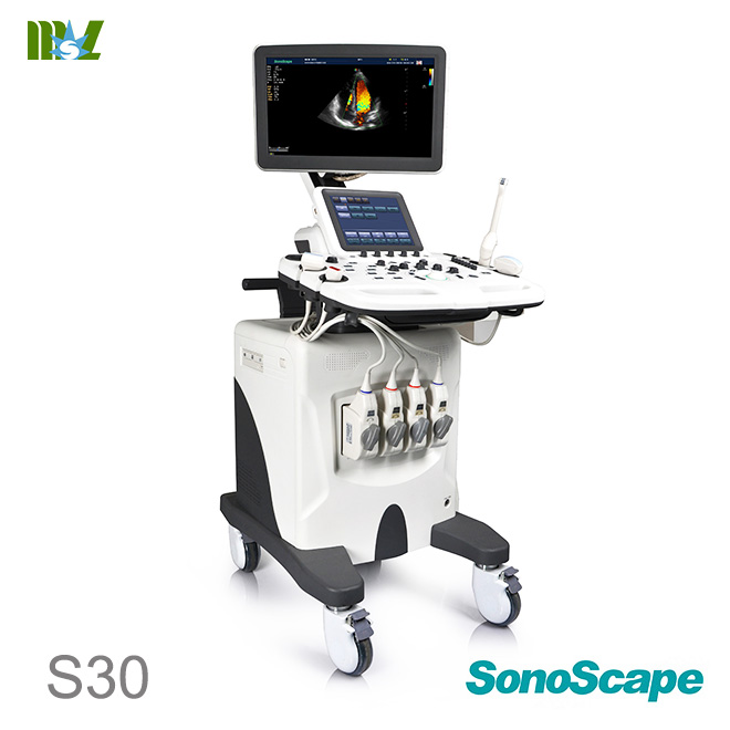 ecografie endovaginala SonoScape S30 price | ecografie doppler