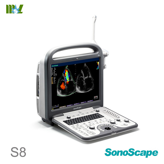 Sonoscape S8 Cardiac Stress Echo color doppler ultrasound