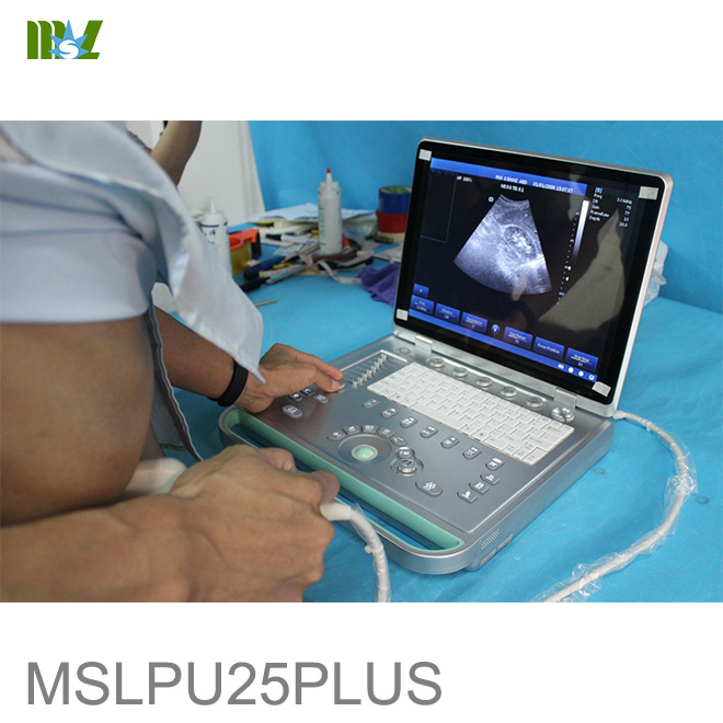 diagnostic ultrasound