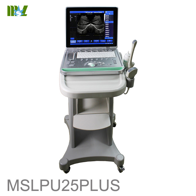 diagnostic ultrasound