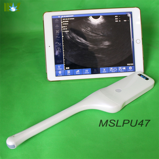 ultrasound probe