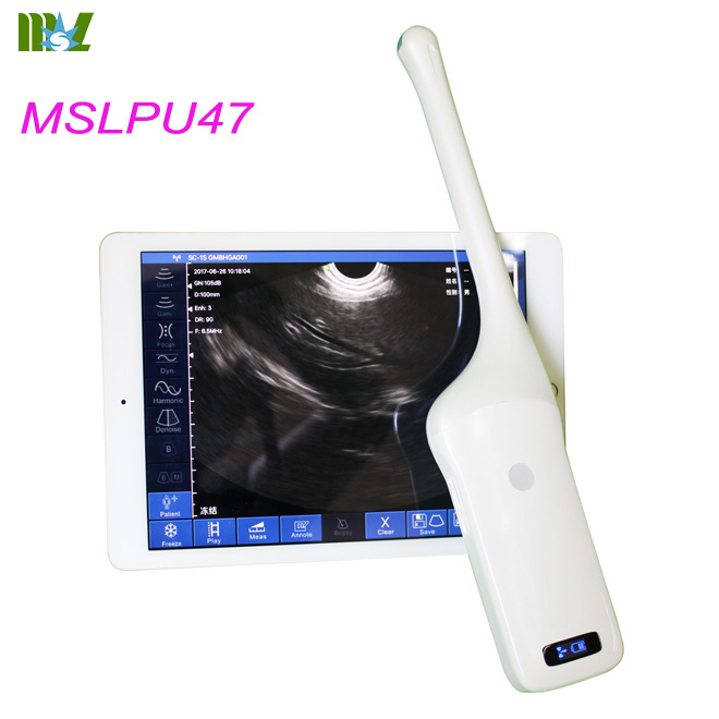 ultrasound probe