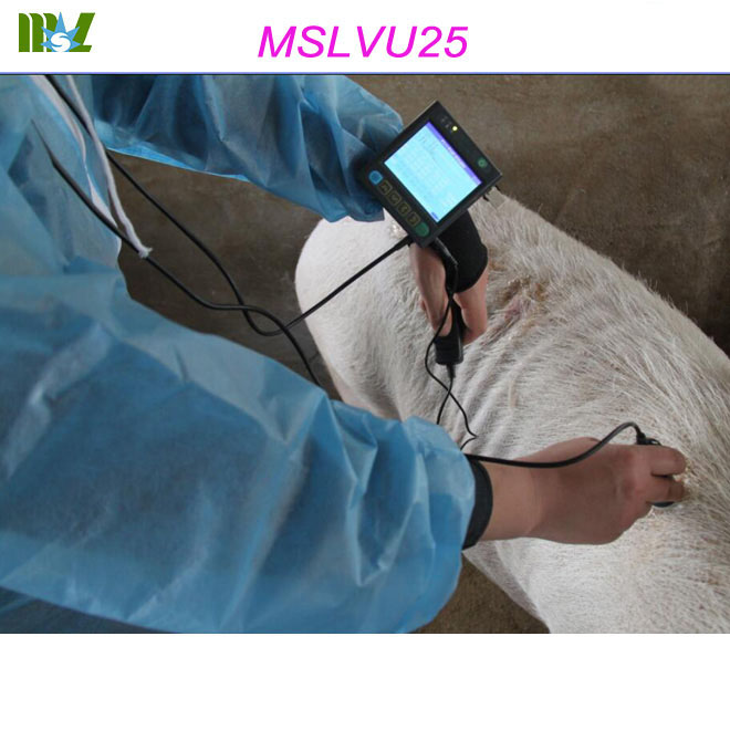 portable ultrasound