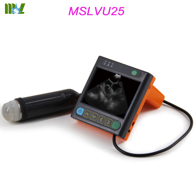 portable ultrasound