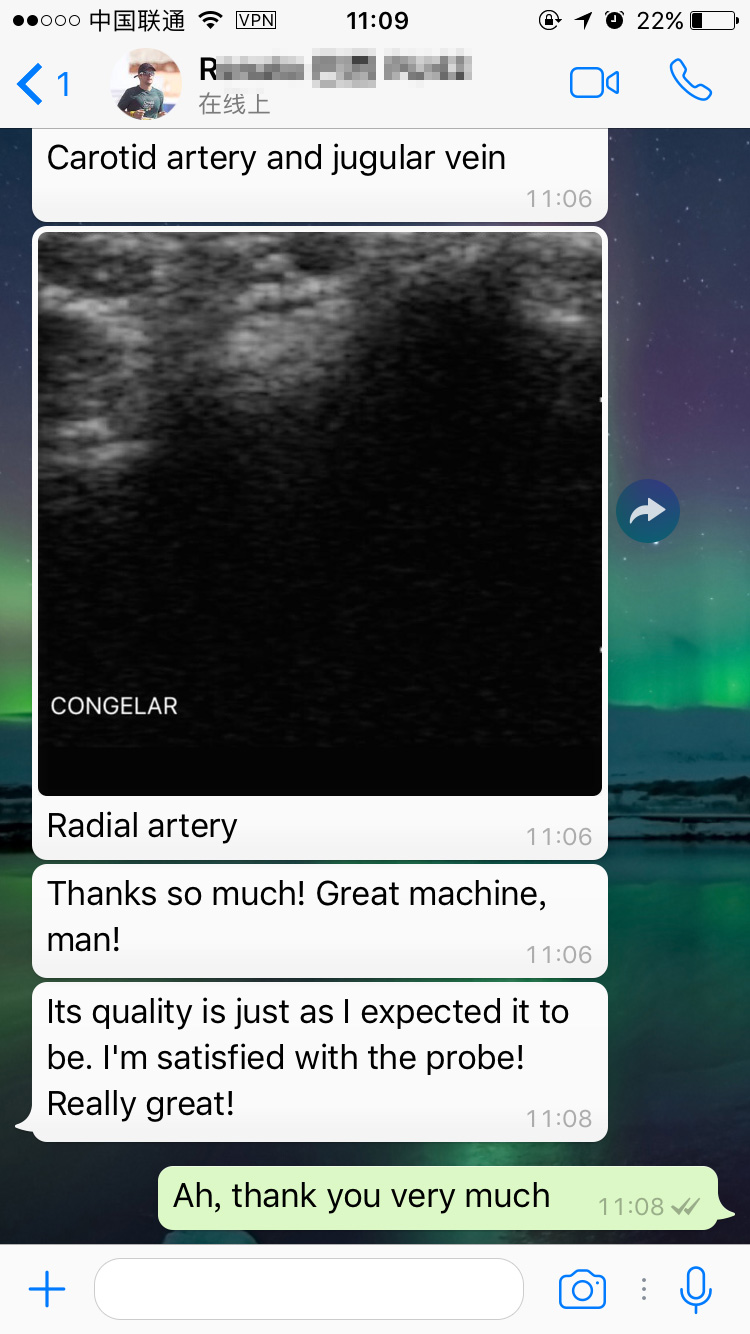 color wireless ultrasound MSLCU89 feedbacks