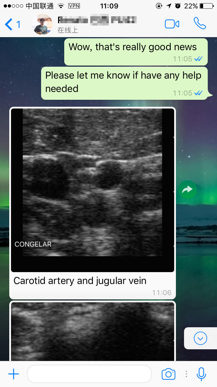 wireless ultrasound MSLCU89 feedbacks