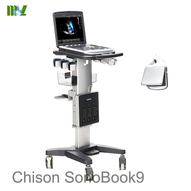 doppler ultrasound