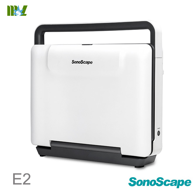 sonoscape E2 price