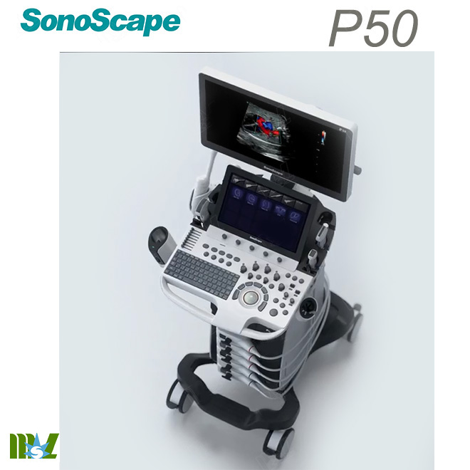 4d scan sonoscape p50