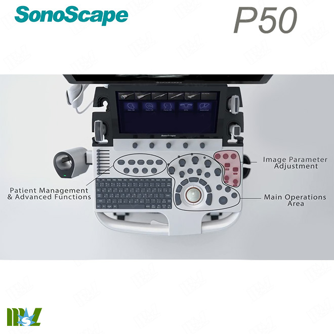 4d ultrasound sonoscape p50