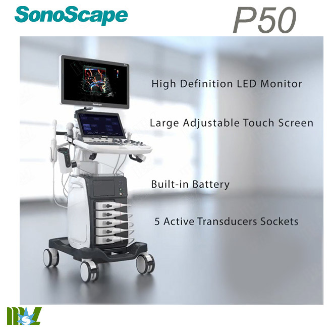 abdominal ultrasound sonoscape p50