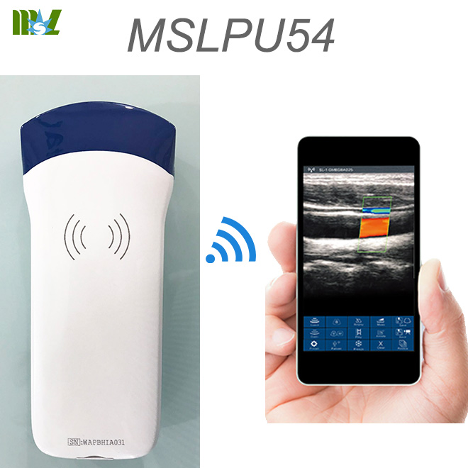 doppler test MSLPU54