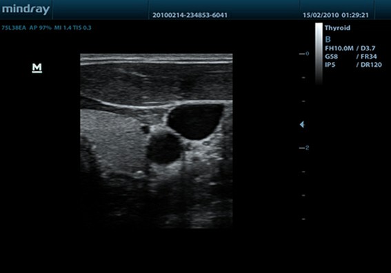 indray ultrasound