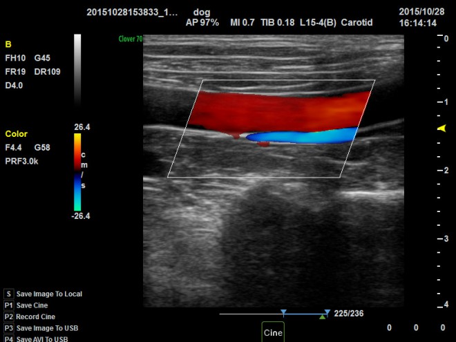 vascular ultrasound