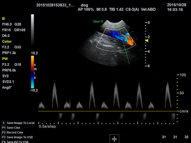 ultrasound scan