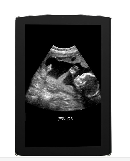 cardiac ultrasound