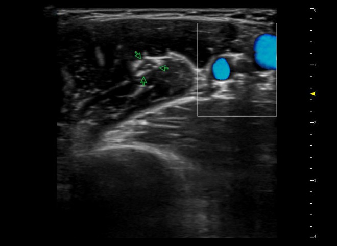 cardiac ultrasound