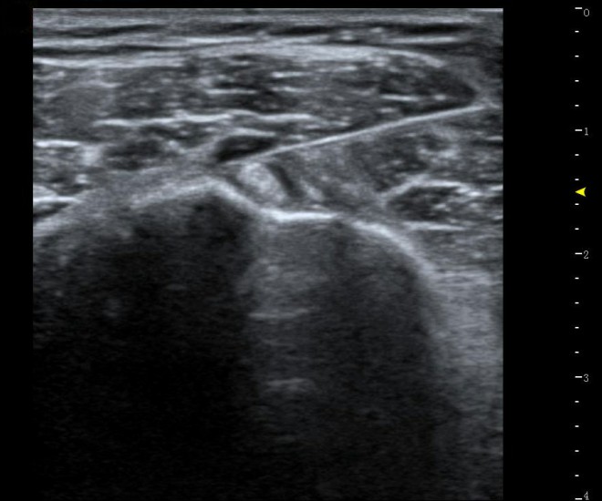 diagnostic ultrasound