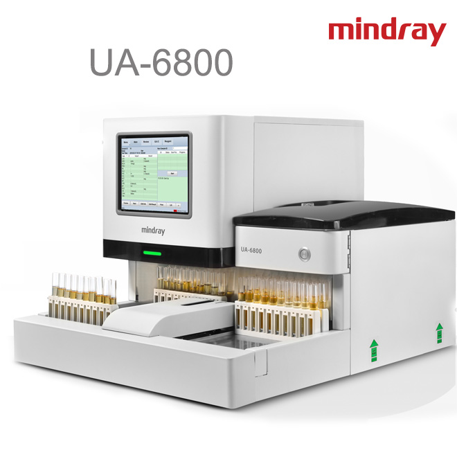 urine analysis