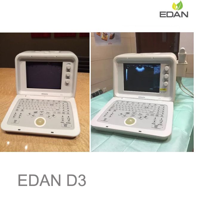 Edan D3 Digital Ultrasonic