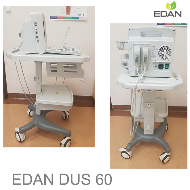 usg machine edan DUS 60