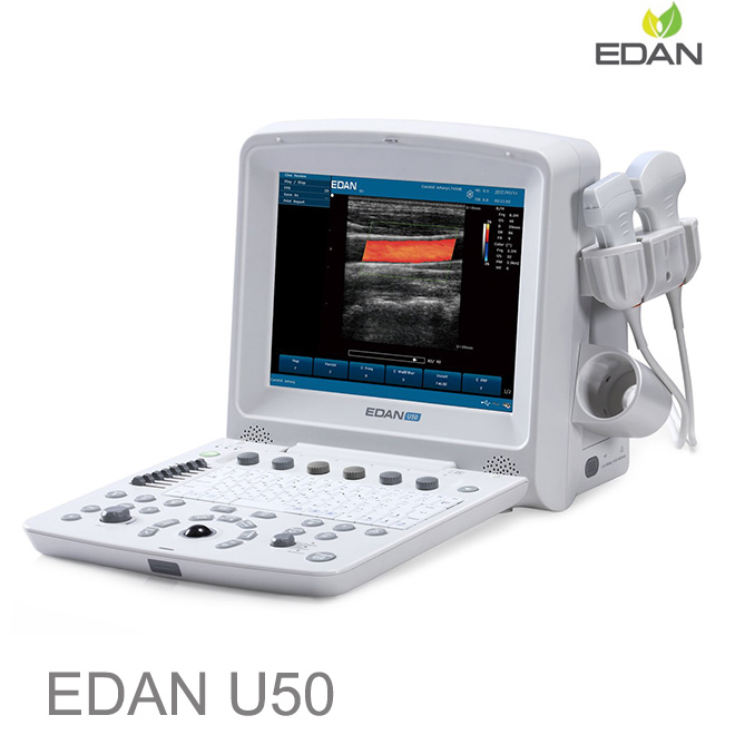 EDAN U50 doppler ultrasound pregnancy