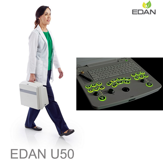 EDAN U50 doppler scan