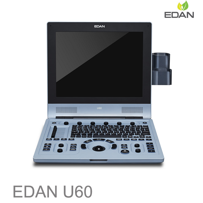 Edan U60 doppler pregnancy