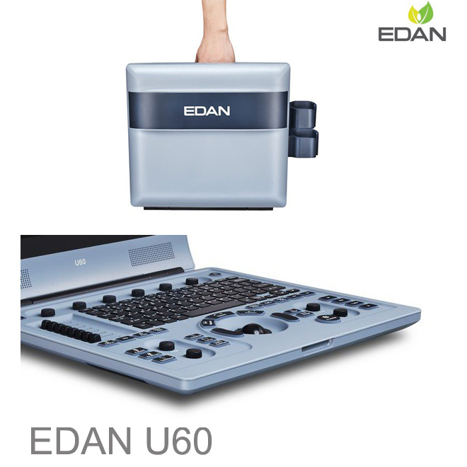 Edan U60 doppler scan