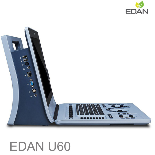 Edan U60 color doppler