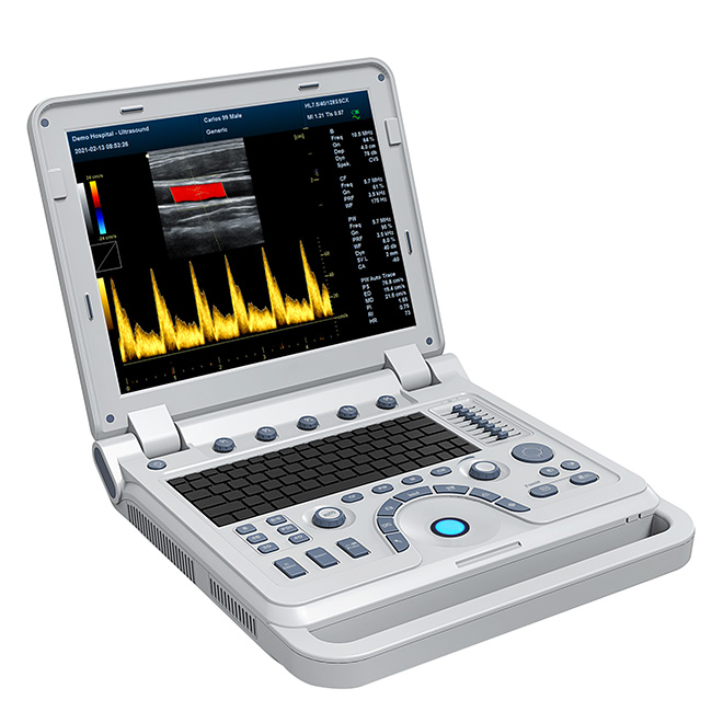 3d ultrasound machine