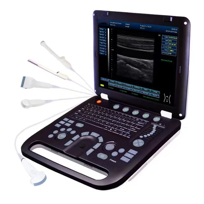 best 3d ultrasound machine